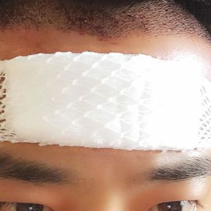 发际线分享社区