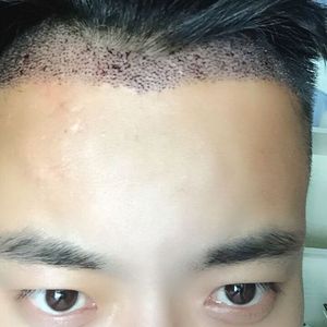 发际线分享社区