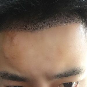发际线分享社区
