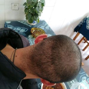 发际线分享社区