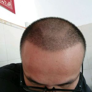 发际线分享社区