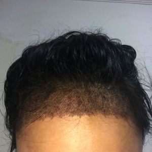 发际线分享社区