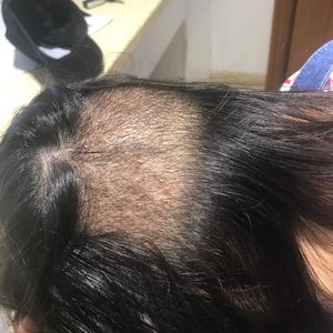 发际线分享社区