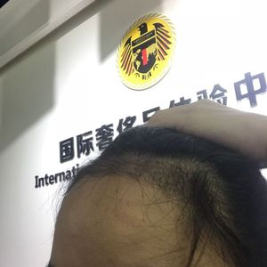 发际线分享社区