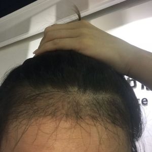 发际线分享社区