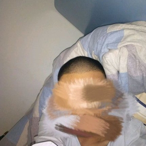 发际线分享社区