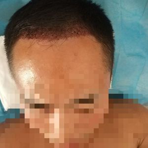 发际线分享社区
