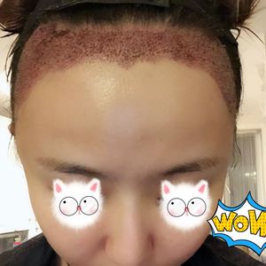 发际线分享社区