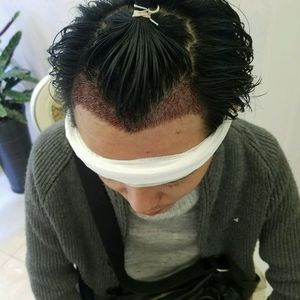发际线分享社区