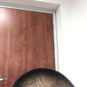 发际线分享社区