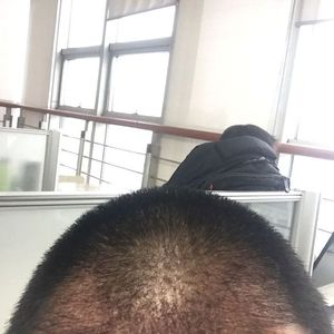 发际线分享社区