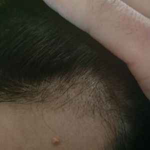 发际线分享社区