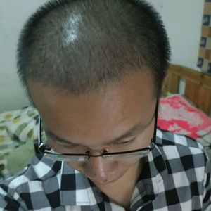 发际线分享社区