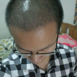发际线分享社区