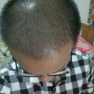 发际线分享社区