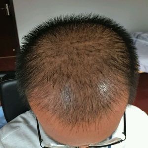 发际线分享社区