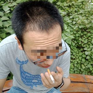 发际线分享社区