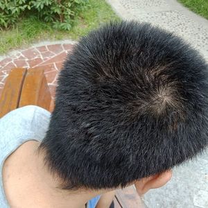 发际线分享社区