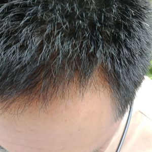 发际线分享社区