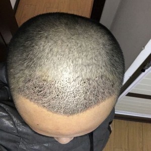 发际线分享社区