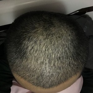 发际线分享社区