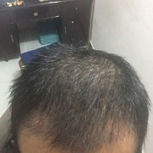发际线分享社区