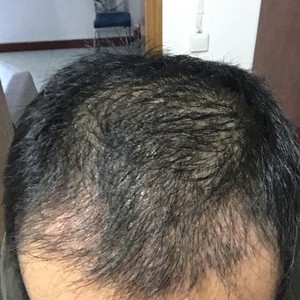 发际线分享社区