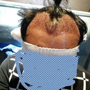 发际线分享社区