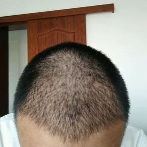 发际线分享社区
