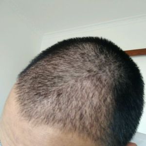 发际线分享社区