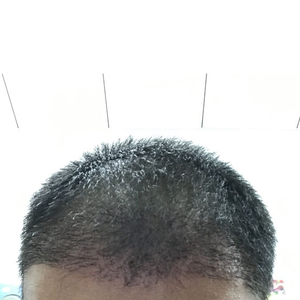 发际线分享社区