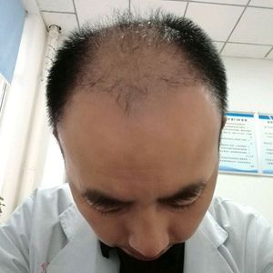 发际线分享社区