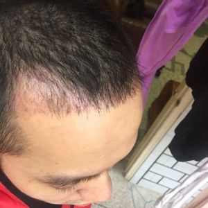 发际线分享社区