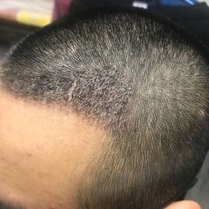 发际线分享社区