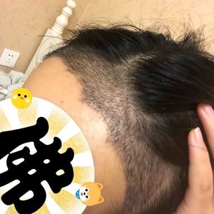 发际线分享社区