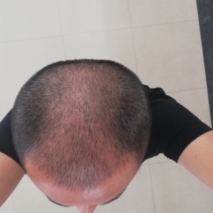 发际线分享社区