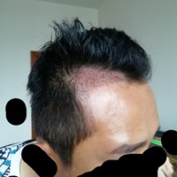 發(fā)際線用戶圖片