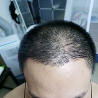 發(fā)際線用戶圖片