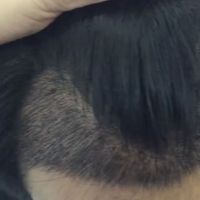 發(fā)際線用戶圖片