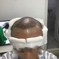 發(fā)際線用戶圖片