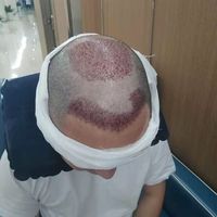 發(fā)際線用戶圖片
