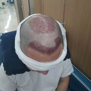 发际线分享社区