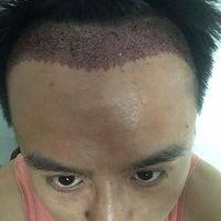 發(fā)際線用戶圖片
