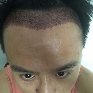 发际线分享社区