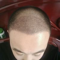 發(fā)際線用戶圖片
