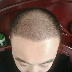 发际线分享社区