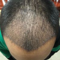 發(fā)際線用戶圖片