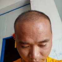 發(fā)際線用戶圖片