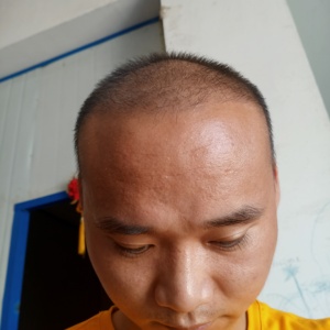 发际线分享社区