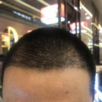 發(fā)際線用戶圖片